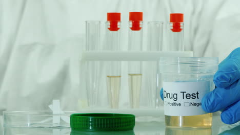 técnico de laboratorio hace una prueba de orina 7