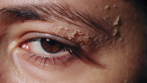 close-up of peeling skin around a human eye