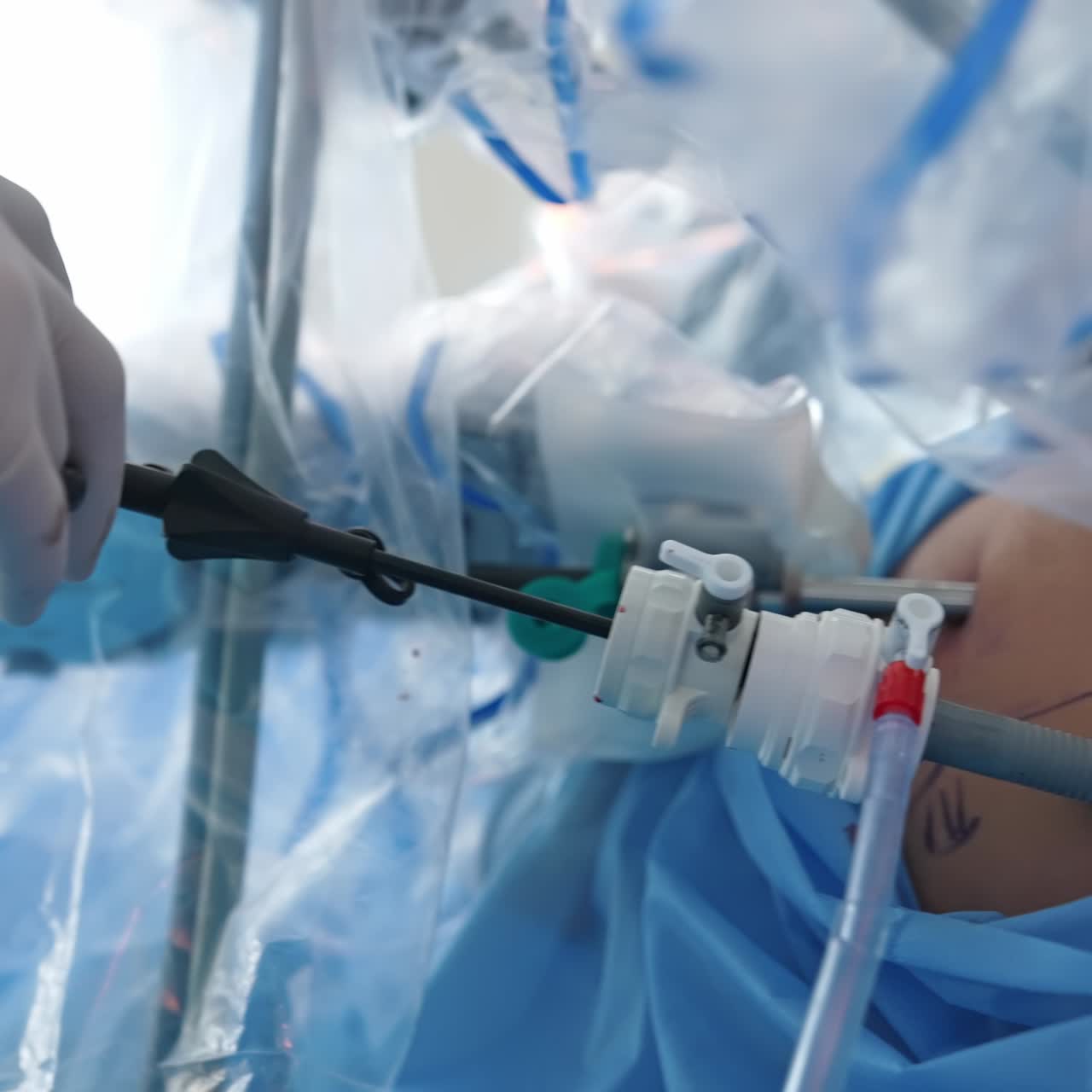 Professional modern medical surgery equipment. Surgeon healthcare treatment technologies