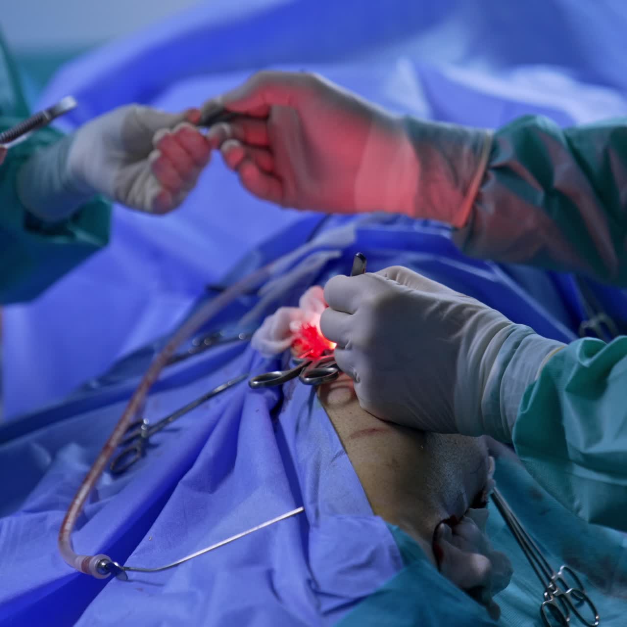 Gloved surgeon's hands hold metal forceps in both hands. Doctor passes the tool to a nurse and takes another one