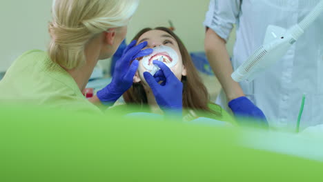 procedimiento profesional de blanqueo de dientes en el consultorio dental