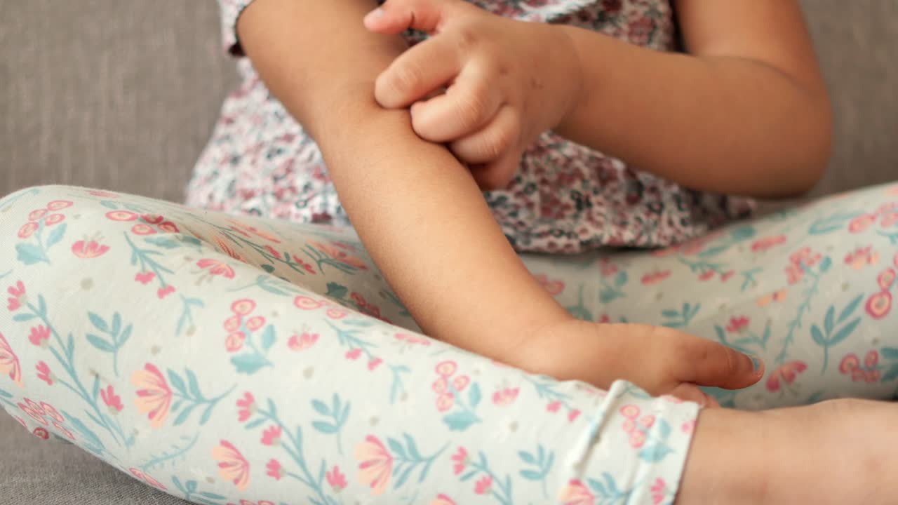 Girl itching her arm