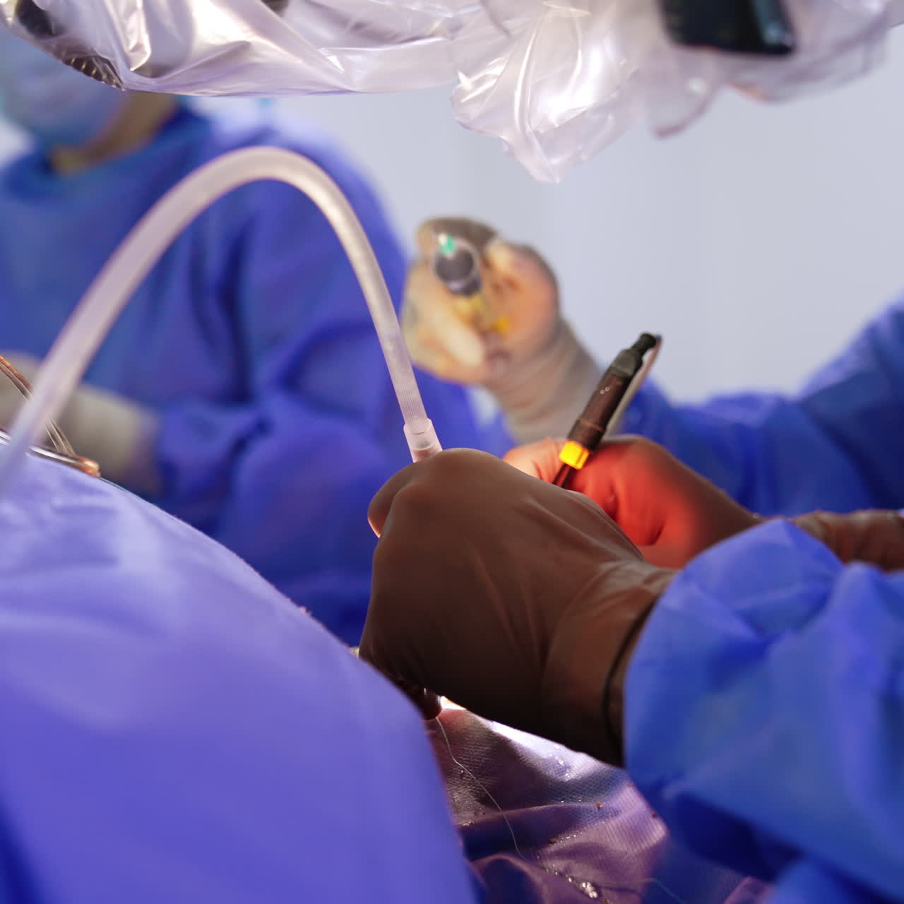 Unrecognized surgeon in latex gloves apply the surgical tools and devices. Assistant pours the medicines on the operational spot from syringe. Close up.