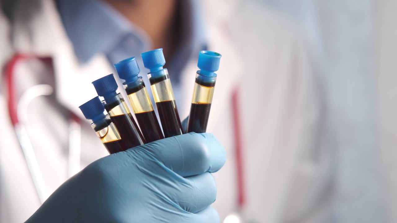 recogida de muestras de sangre