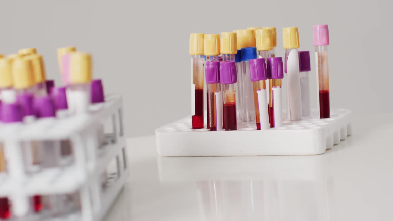 Video of close up of test tubes on white background