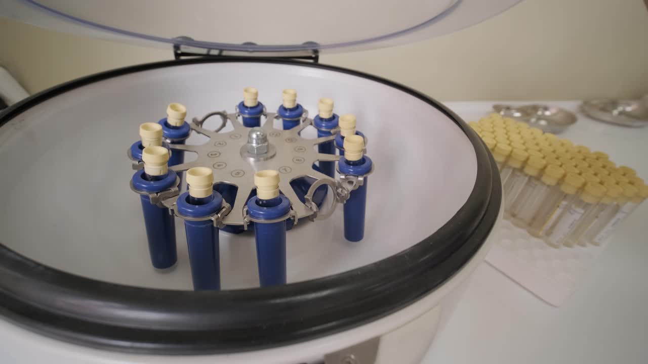 preparación de plasma rico en plaquetas. tubo con sangre en las manos. centrifugadora.