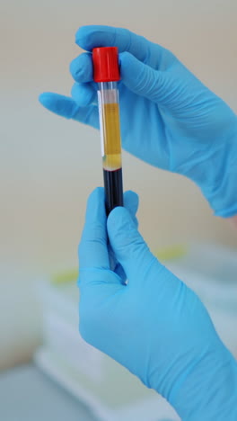scientists researching in laboratory. hand of a scientific taking a blood sample tube vertical video