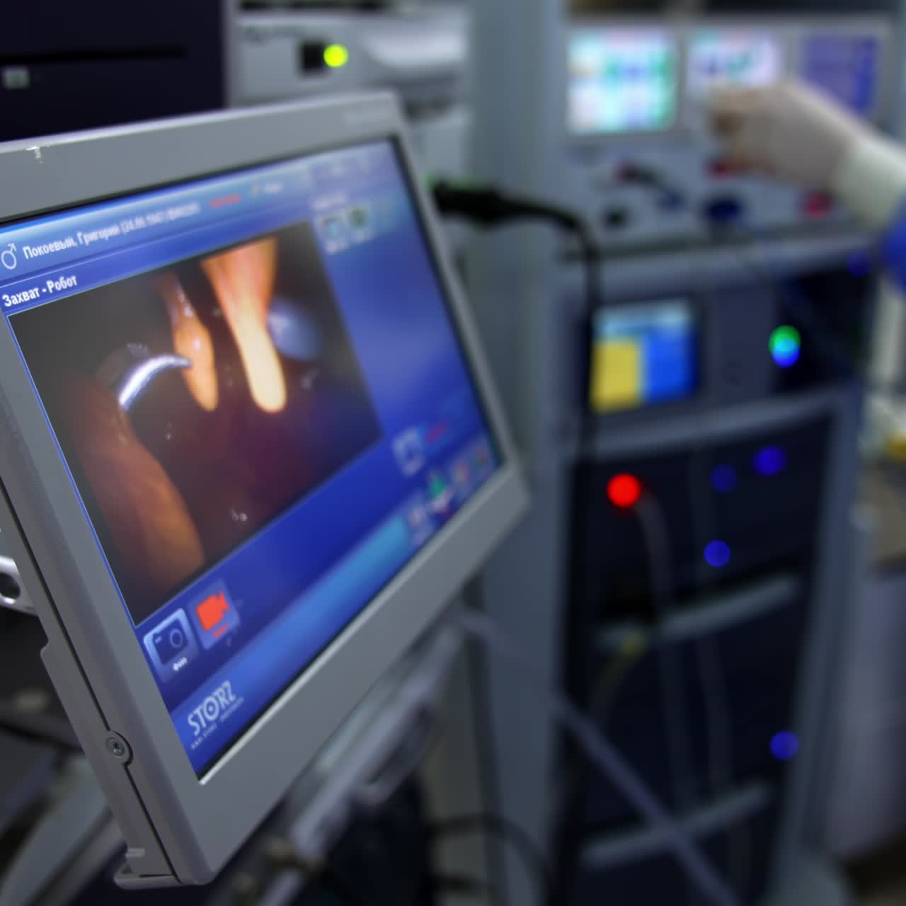 Equipment screen image with surgical operation in process. Medic standing beside pressing the buttons on the apparatuses. Blurred backdrop