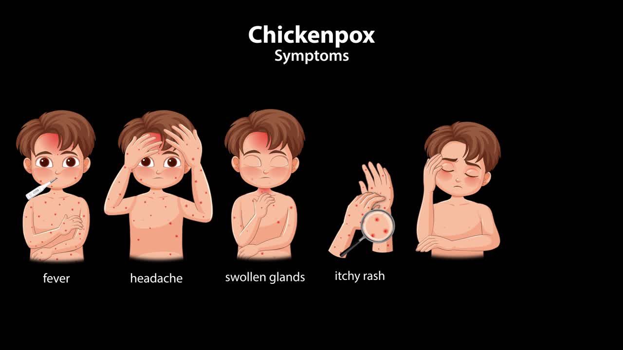 Cartoon boy displays chickenpox symptoms progression, including fever, rash, fatigue, and loss of appetite