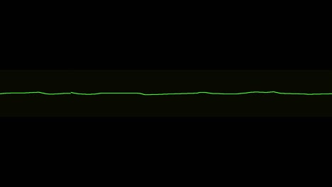 ecg shows asystole