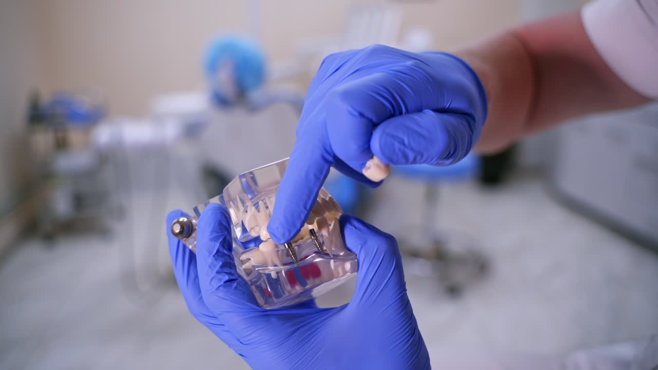 Doctor shows fake implants on a plastic jaw sample or model. Modern dental clinic background. Blue medical gloves on doctor's hands. Dental Hygiene and Health concept video. Implants in jaw.