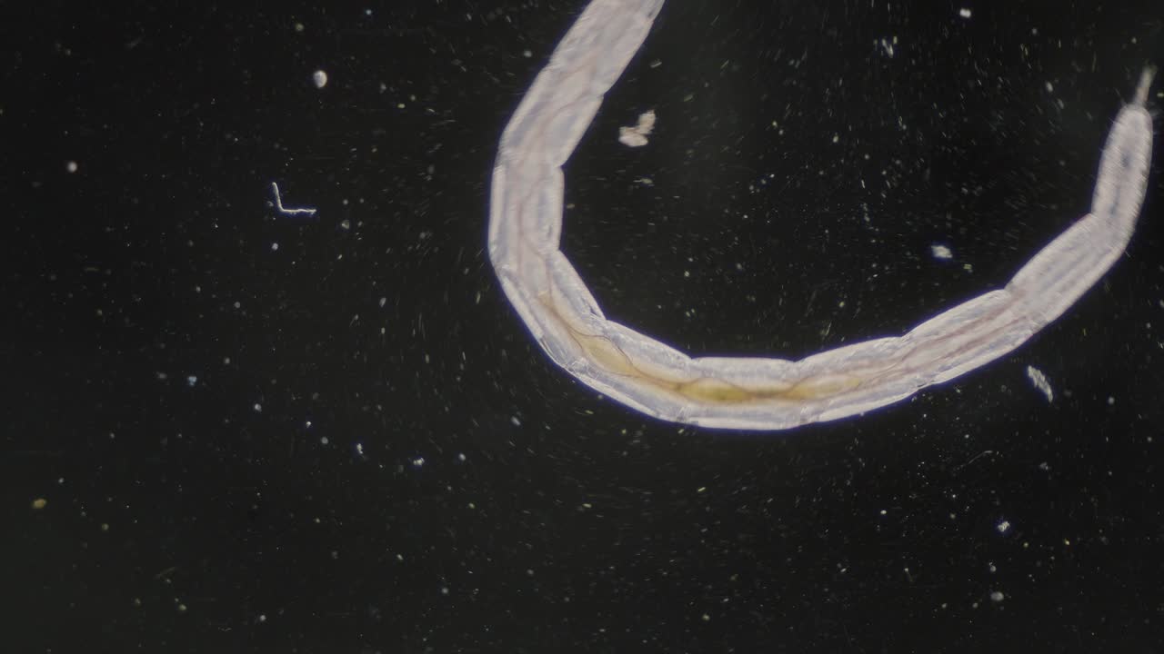 gusano trematodo nematodo de movimiento rápido bajo el microscopio vista de campo oscuro