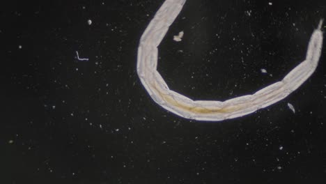 Gusano-Trematodo-Nematodo-De-Movimiento-Rápido-Bajo-El-Microscopio-Vista-De-Campo-Oscuro