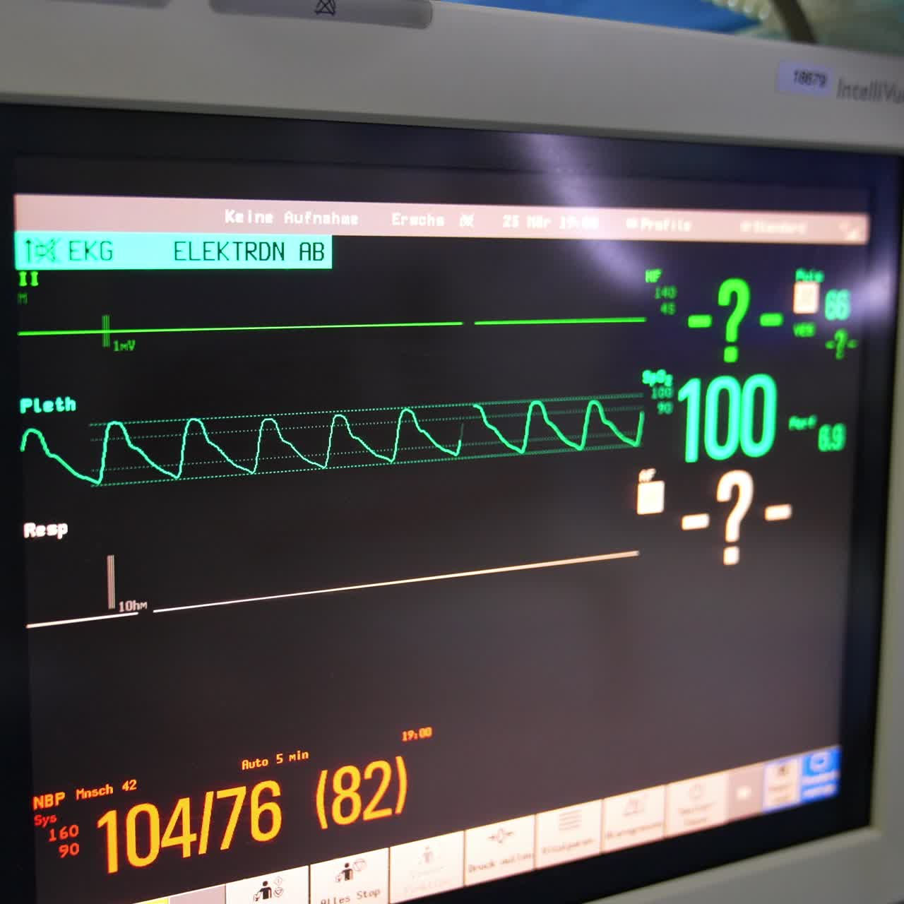 Heart rate curve on the black screen of monitor. Controlling the condition of patient under surgery. Close up