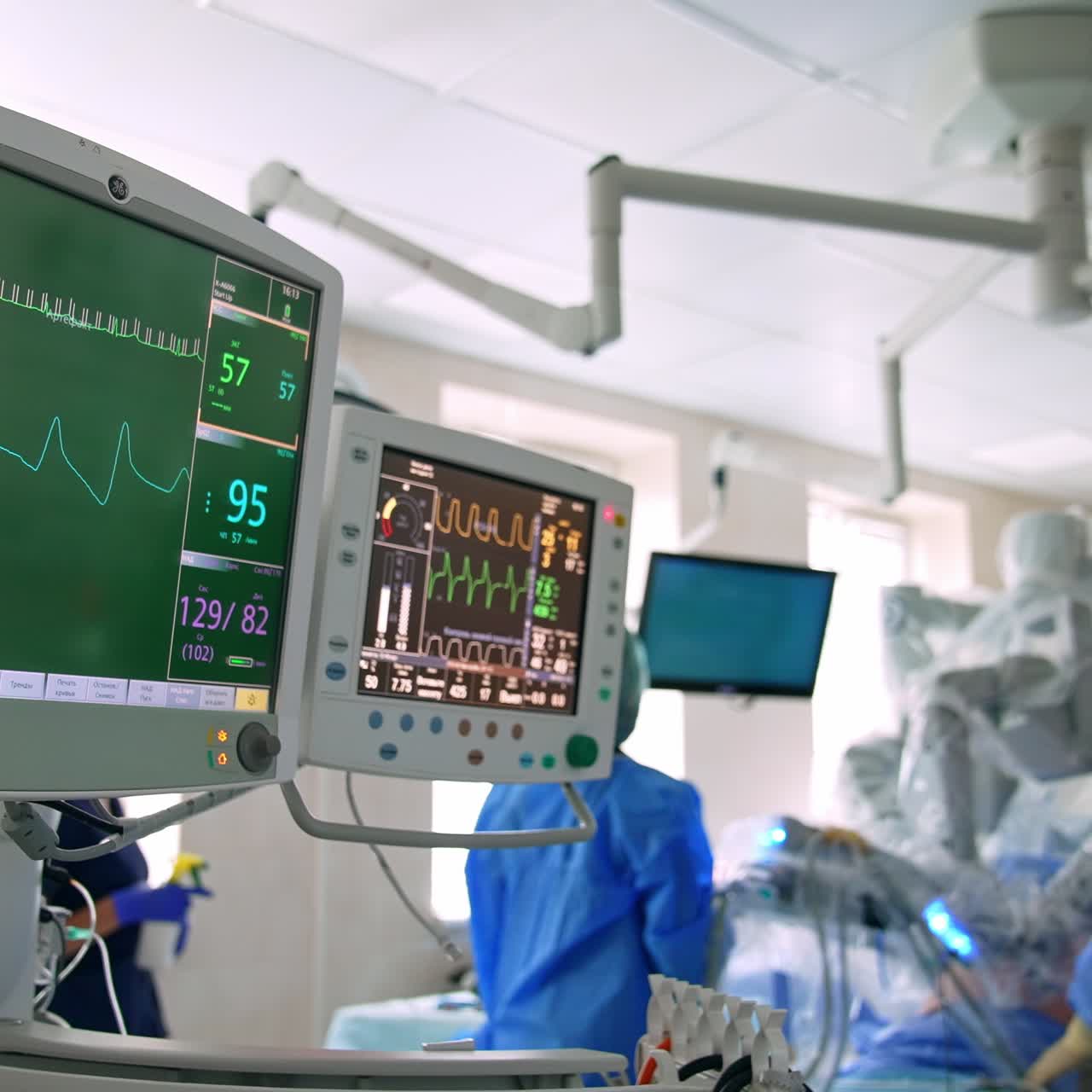Attrezzature avanzate accese durante l'operazione. Gruppo di medici che opera con l'aiuto della macchina robotica Da Vinci