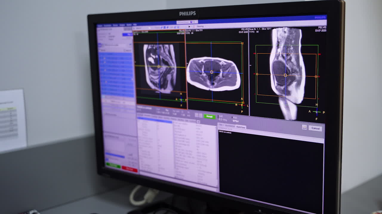 Medical Imaging Display on Monitor