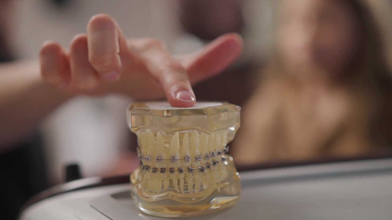 Primo Piano di un Modello Dentale con Apparecchio Ortodontico che Mostra Denti Dettagliati e Componenti Ortodontici. Una Mano Indica un Bite in Plastica Trasparente in Esposizione in un Ambiente Interno. L'Illuminazione Soffusa Evidenzia la Texture.