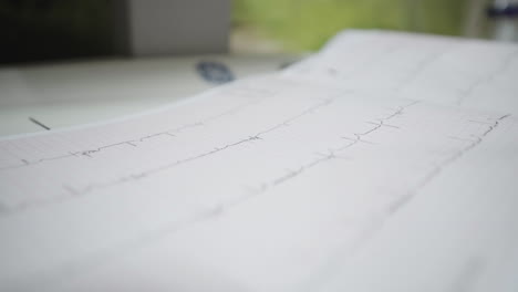 líneas cardíacas de ecg informes de actividad del paciente estable primer plano