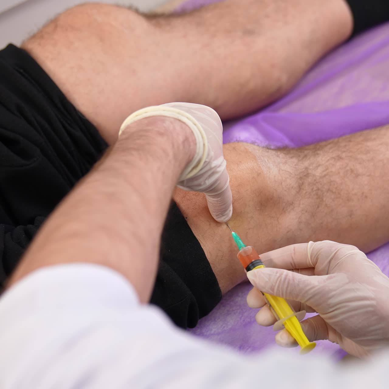 Injection of medicines into a knee. Gloved hands make a shot to a patient's leg lying on the bed. Top view