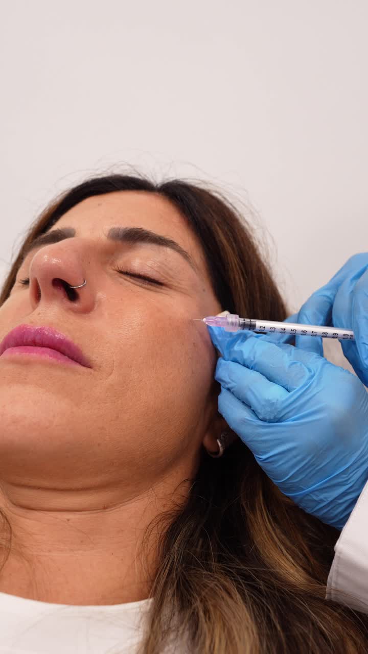 Donna che riceve un'iniezione di filler dermico