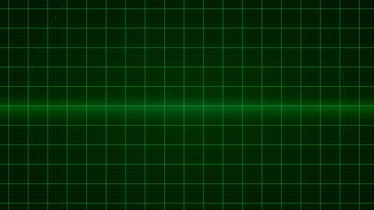 Green Radar Screen Scanning Motion Graphic