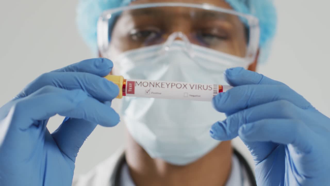 African american male doctor wearing face mask, holding vial with monkeypox virus