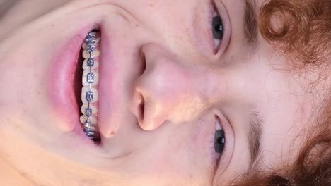 closeup of the face of a satisfied crazy happy young guy with braces closeup of the face of a satisfied crazy happy young guy with braces positive curly redhaired student on a light blue background