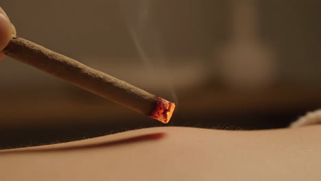 moxibustion treatment on skin
