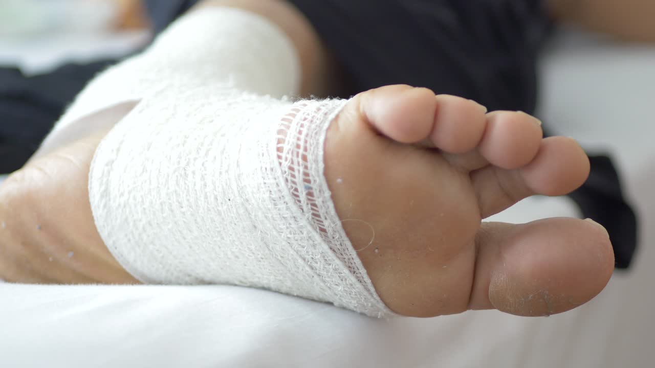 mujer con el pie vendado de cerca ,