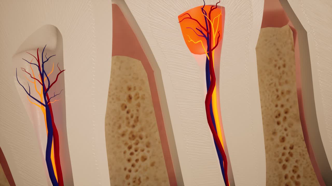 치아 통증: 치아의 해부학적 상세한 부분, 신경 염증, 3d 애니메이션