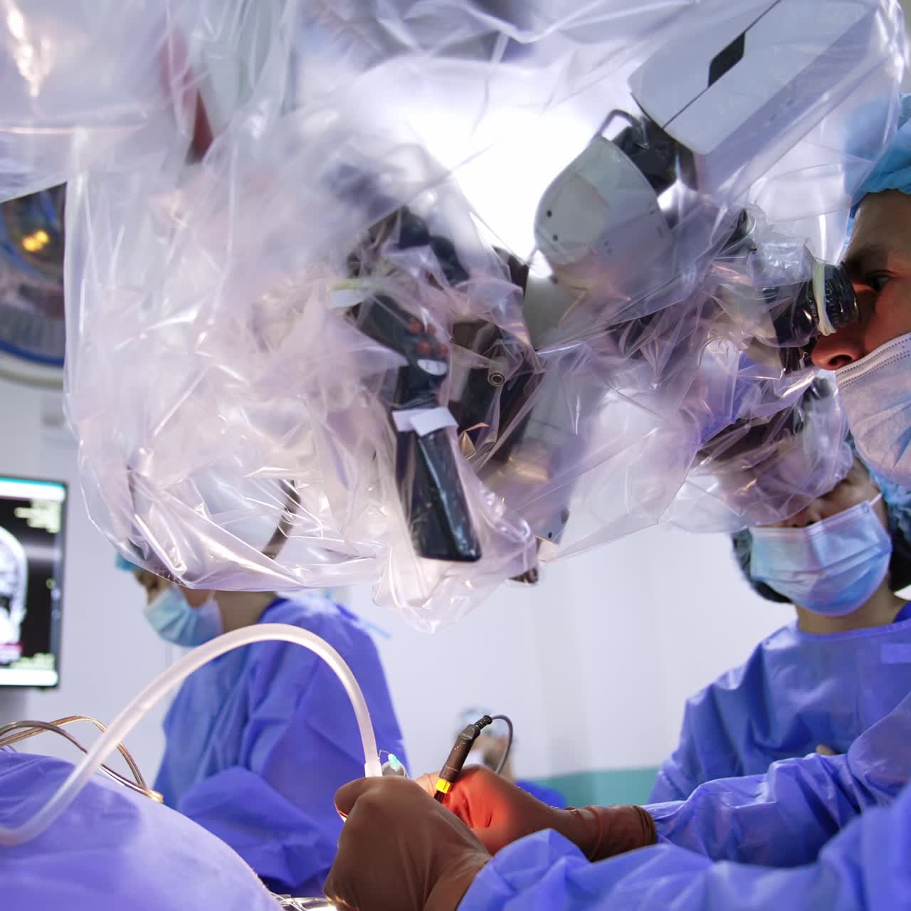 Attentive neurosurgeon performs brain surgery using modern technological microscope. Two female nurses assist the surgeon in operational room. Low angle view