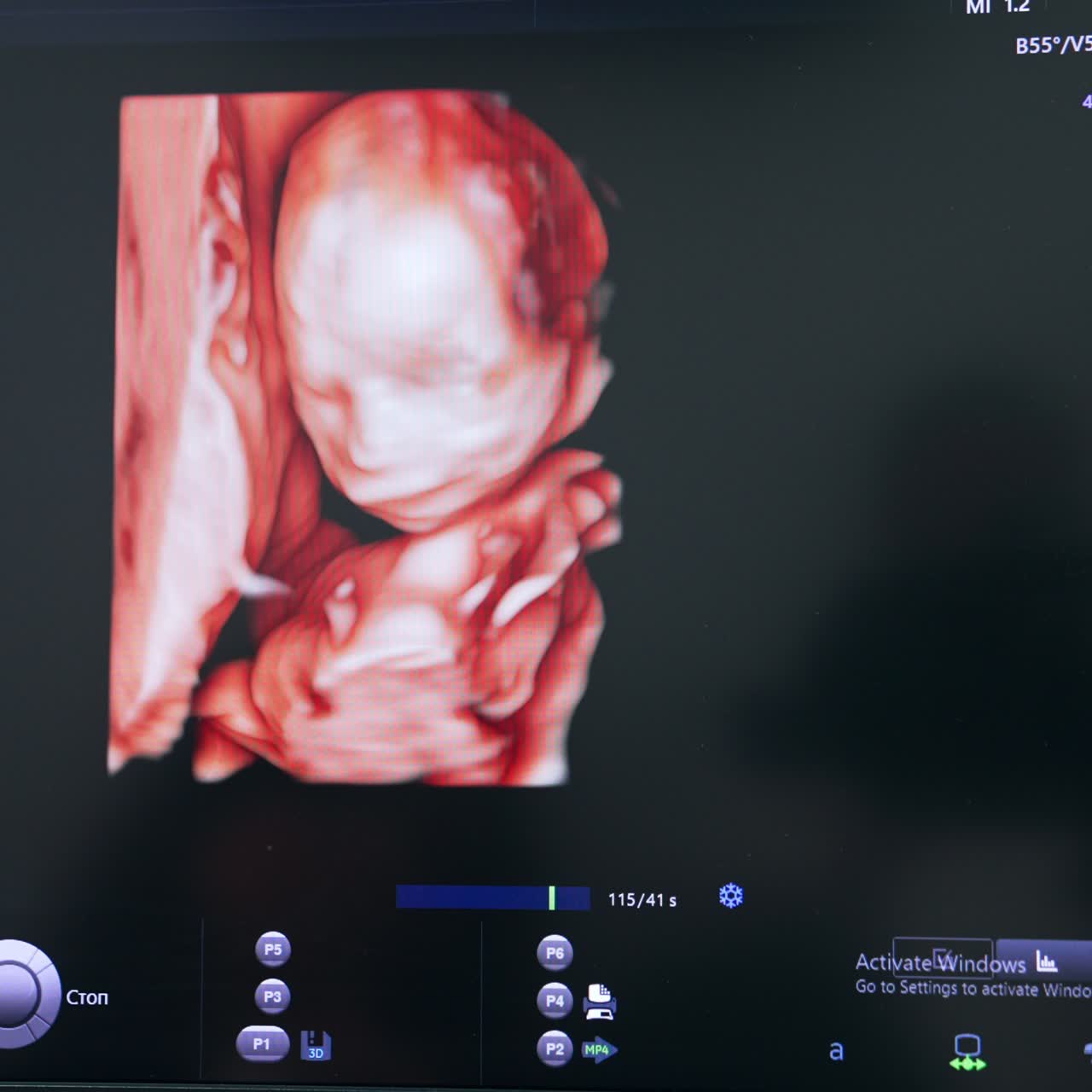 Prenatal image of a baby in mother's womb. Examination of an yet unborn child on the ultrasound equipment. Close up