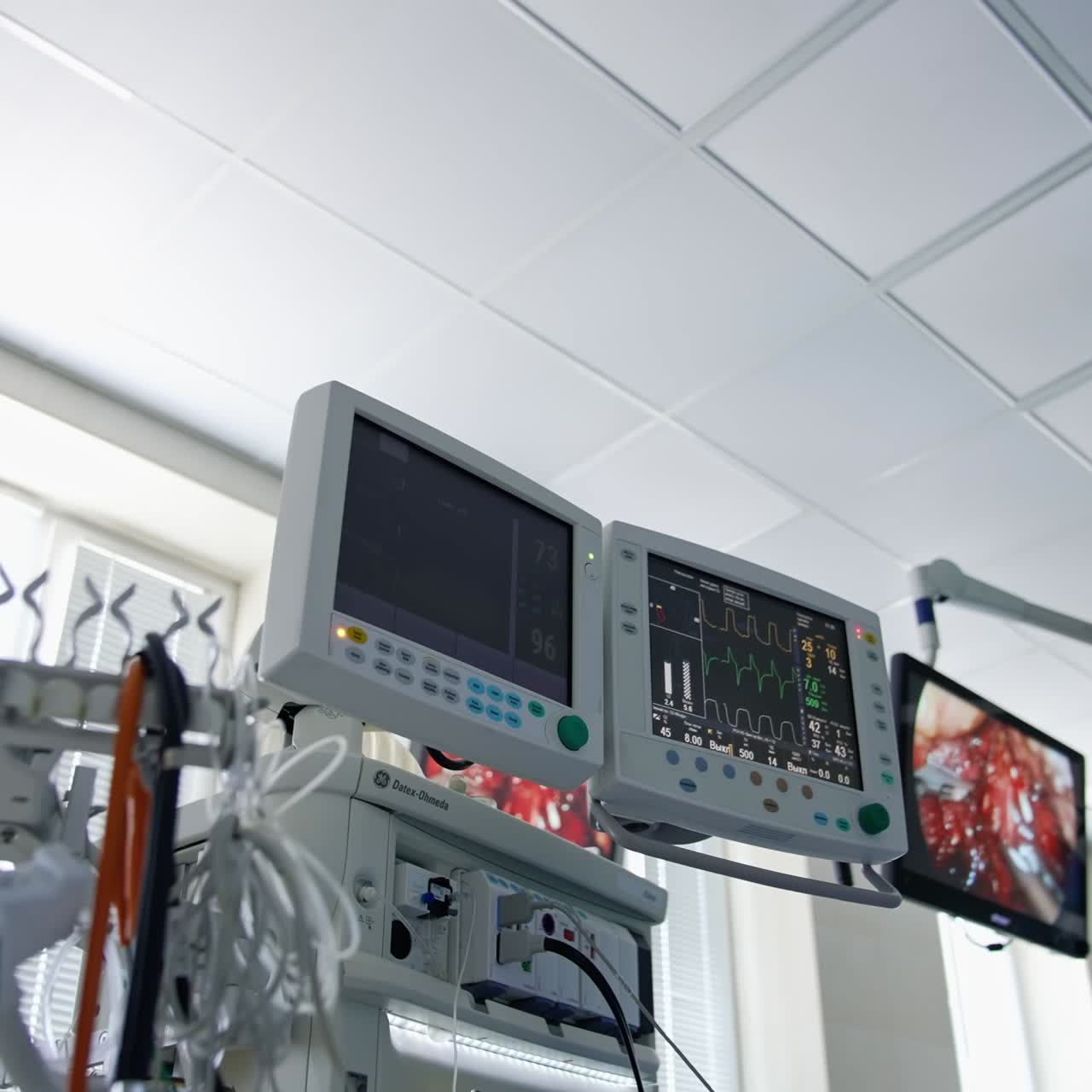 Monitor della frequenza cardiaca con diagramma. Primo piano dei segni vitali digitali di un monitor per la misurazione della frequenza cardiaca e della pressione sanguigna.