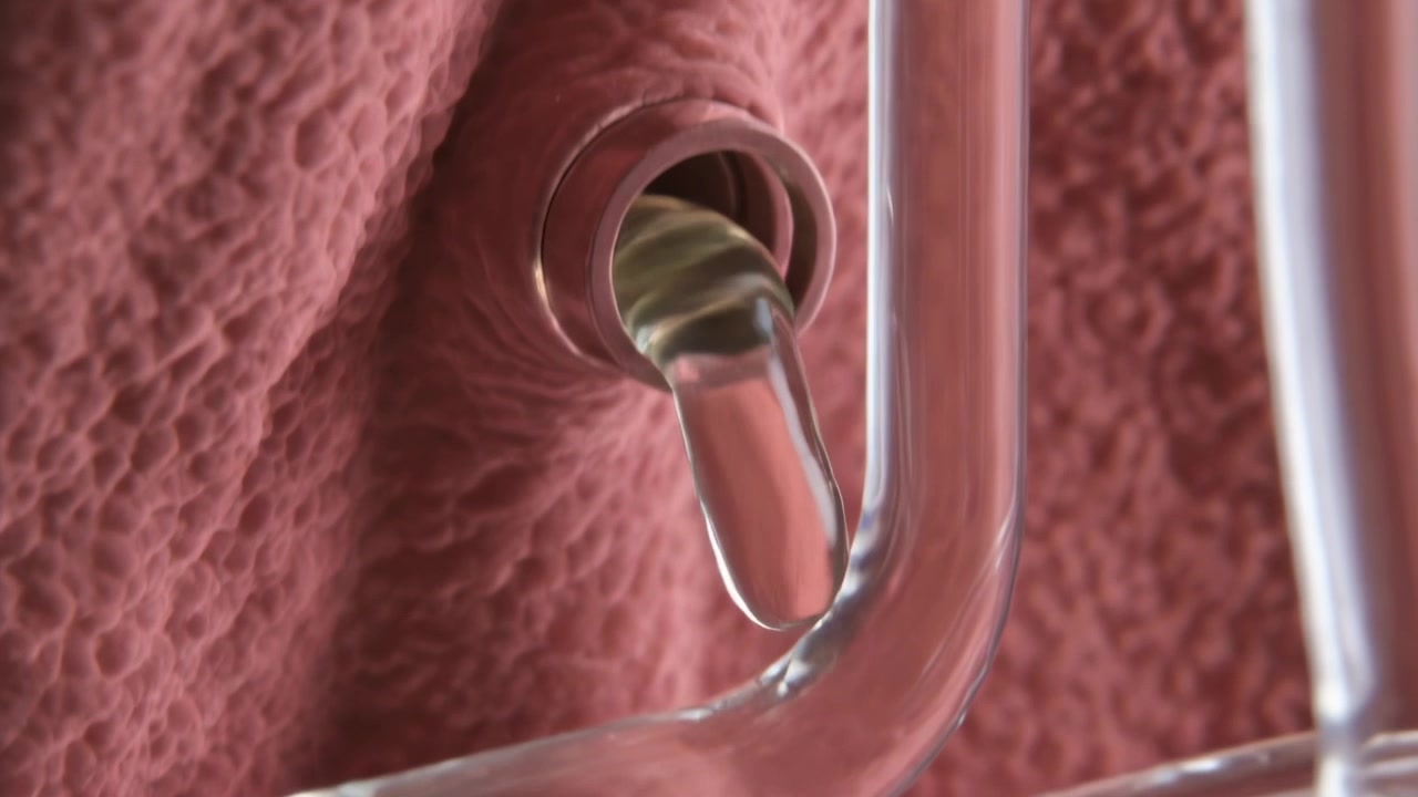 Opening circular duct revealing lumen and ejecting amber droplet onto pink tissue and clear tubing