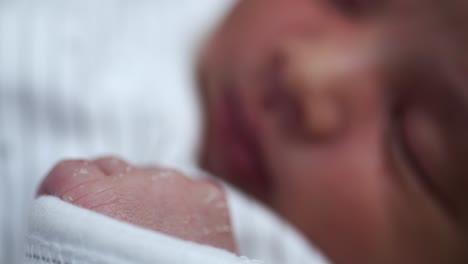 nærbillede af tør, brudt hud på den nyfødte babys hånd