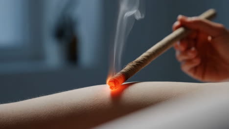 close-up of moxibustion therapy on a leg