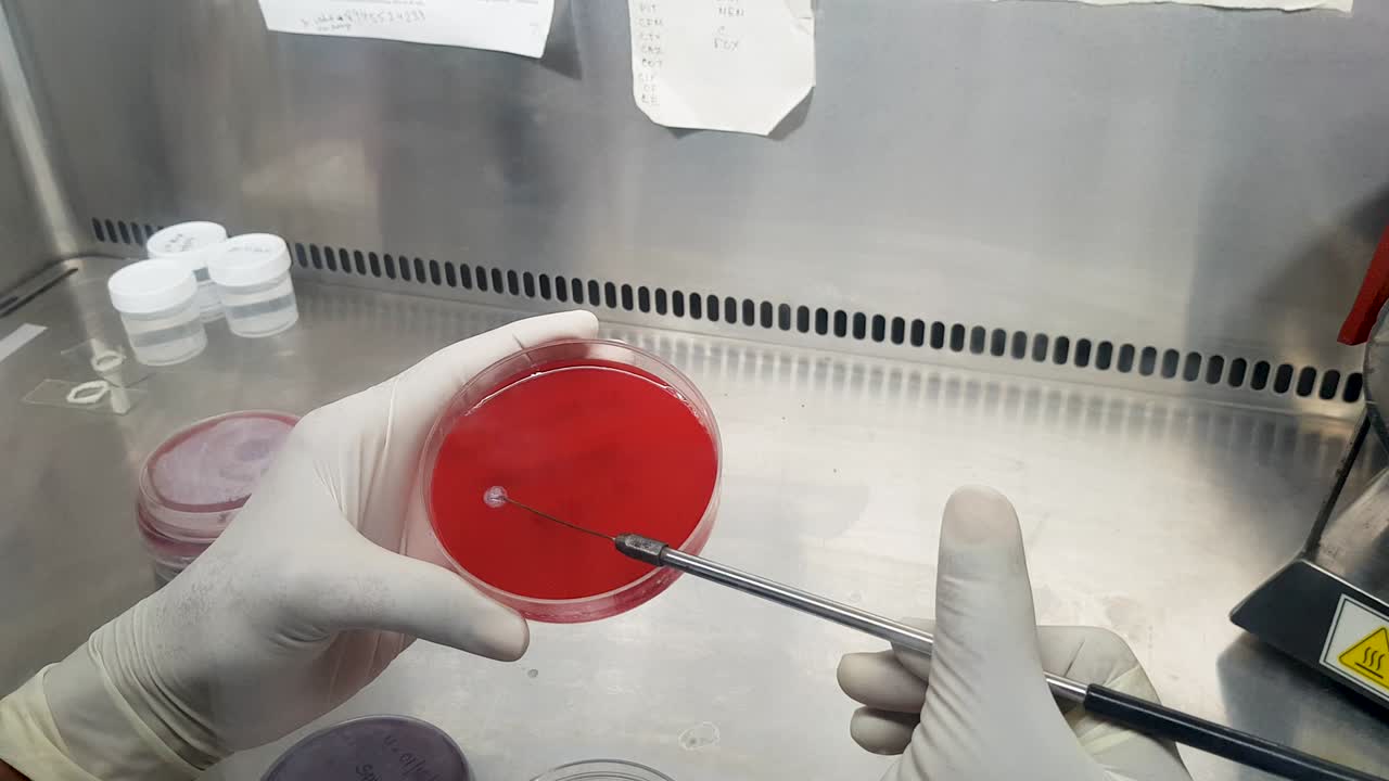 inoculation of pus sample in a blood agar culture plate by an inoculation loop