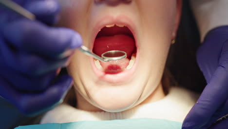 dental checkup