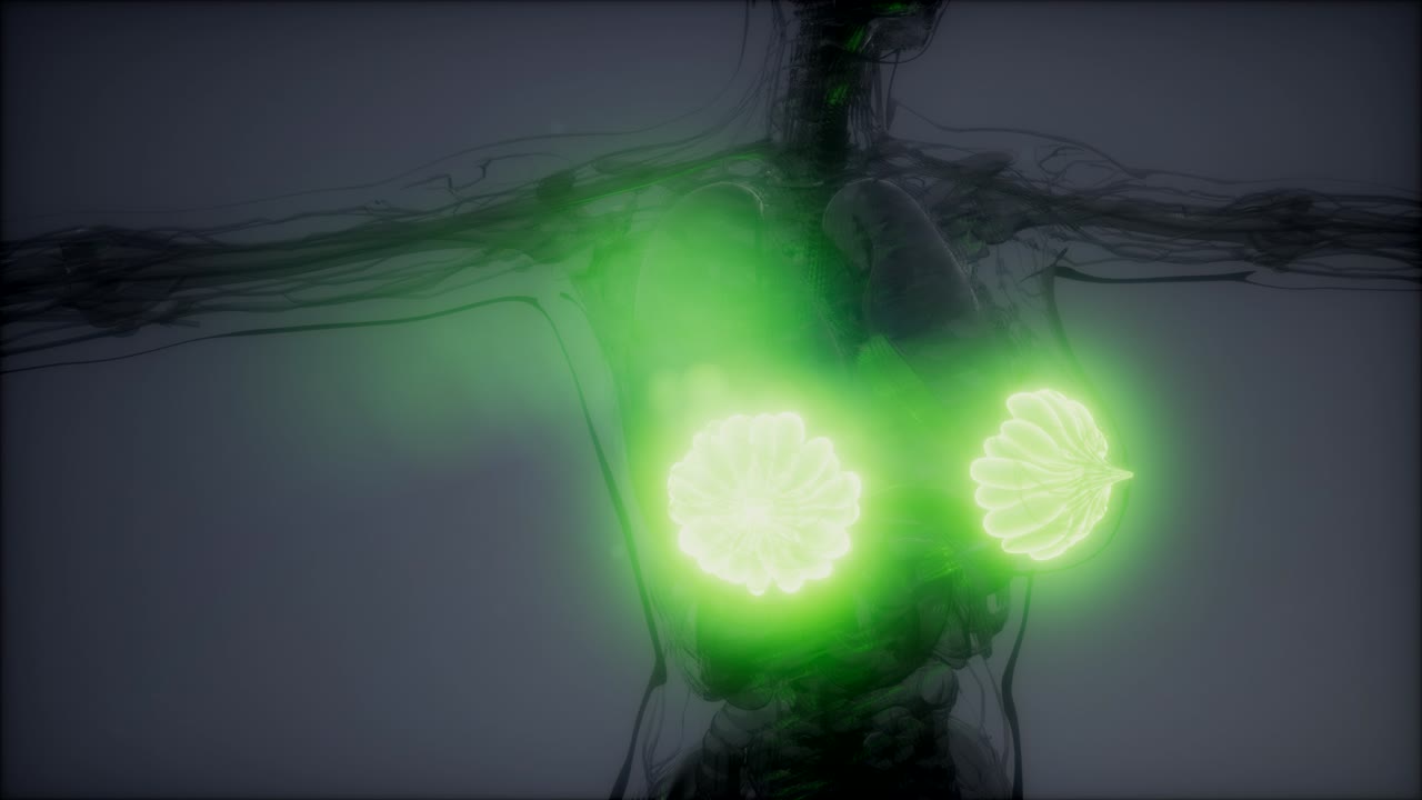 비만 여성의 유방선에 대한 의학적으로 정확한 그림