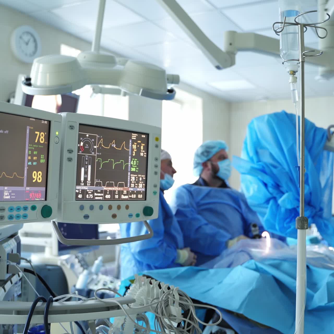 Monitor medici in funzione durante un intervento chirurgico. Gli schermi mostrano le condizioni del paziente con medici che eseguono un'operazione in clinica sullo sfondo