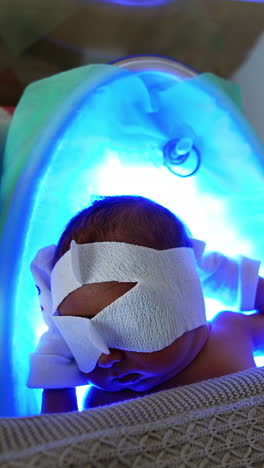 baby lies in a crib under blanket and on the uv lamp. newborn is undergoing jaundice treatment by photo therapy. top view. vertical video