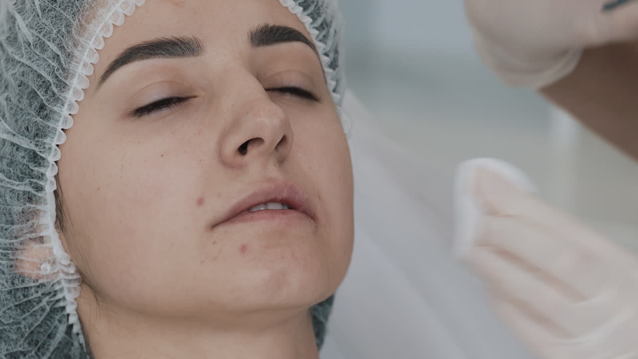 Woman receiving lip filler injection in a cosmetic clinic