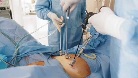 laparoscopic surgery procedure