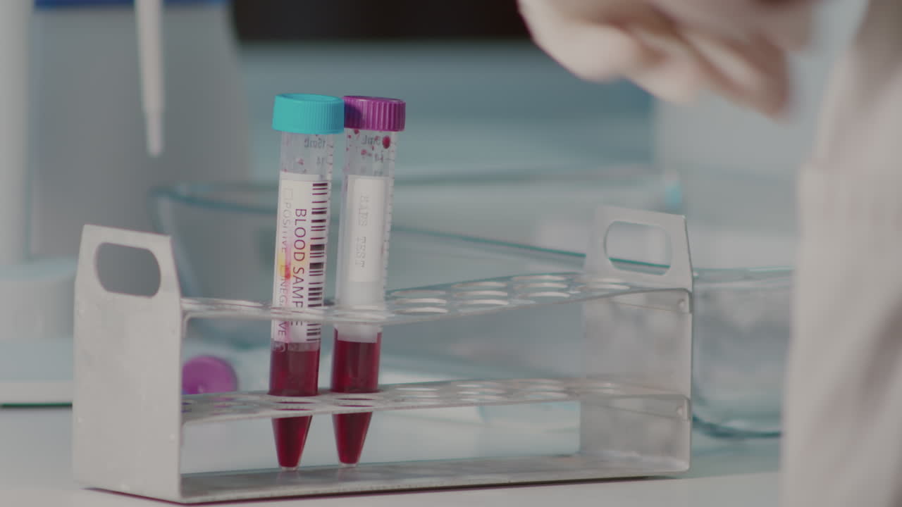Blood sample in test tube and hand picking it up, closeup view