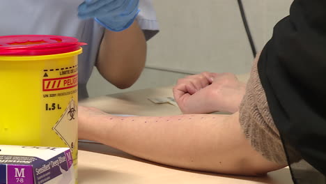 allergy testing procedure