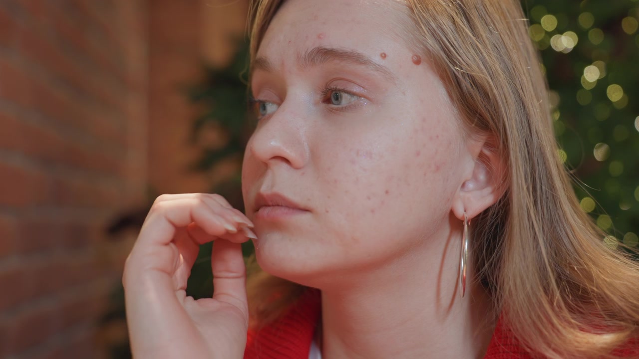 Primo piano di giovane donna pensierosa con acne davanti a un albero di Natale