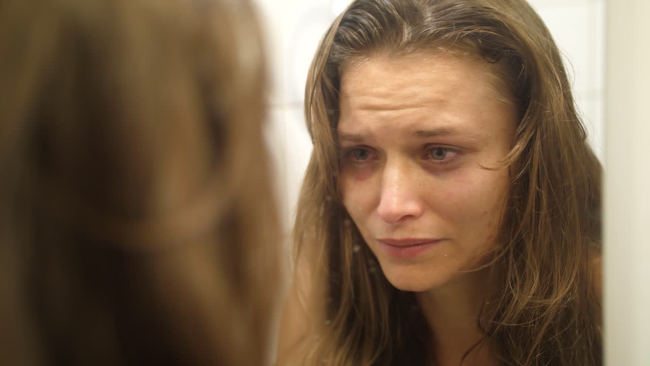 una mujer con moretones y cicatrices en la cara por haber sido golpeada y golpeada se mira en el espejo llorando y tocándose las heridas doloridas en la mejilla