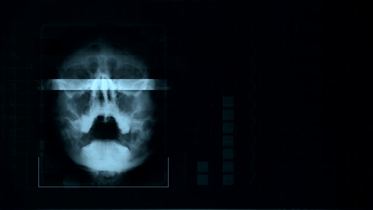 Scan of a human skull, looped Gray hud interface medical equipment