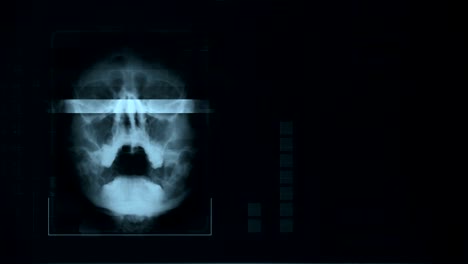 scan of a human skull, looped gray hud interface medical equipment