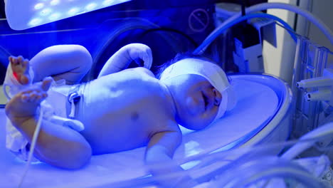 infant under phototherapy in incubator